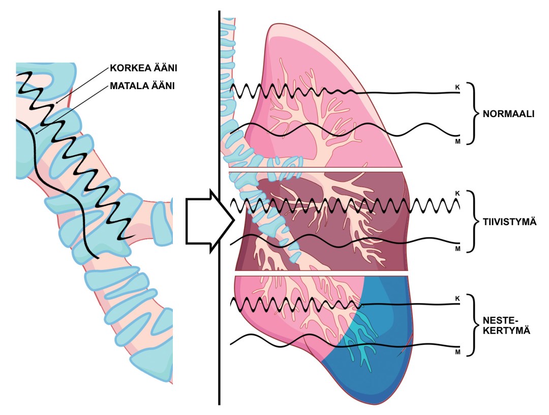 aaltojen_johtuminen_v1