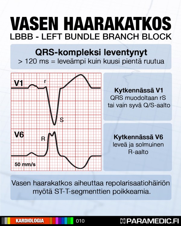 010_lbbb_v1