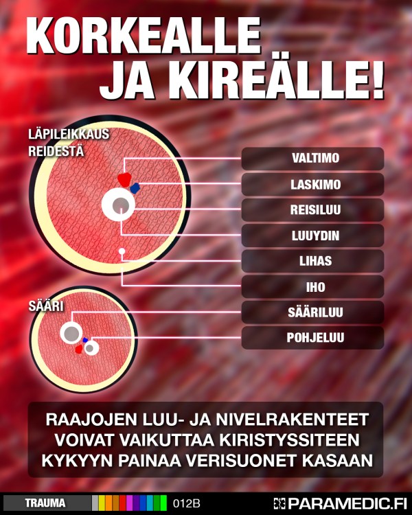 012B_kiristysside_v2